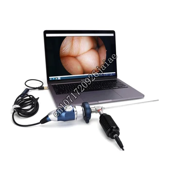 Camjoy 1080p Медицинская CCD портативная USB-эндоскопия endoscope HD для ЛОР
